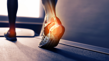 6 Reasons You May Have Heel Pain (Without Injury)